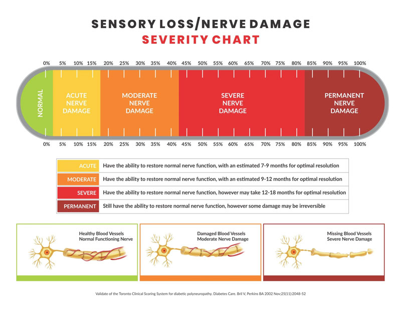 Nerve Damage Chart