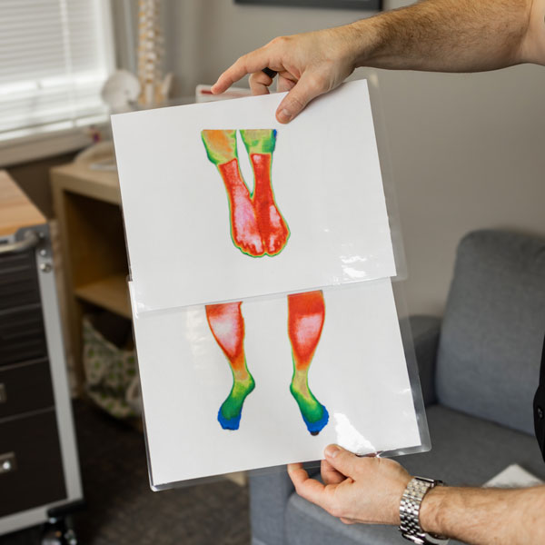 Dr holding photos of nerve scans in legs